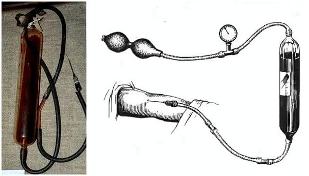 Переливание крови в походных условиях. Реально ли?